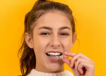 Malocclusioni, un allineatore trasparente per gli adolescenti in fase di crescita