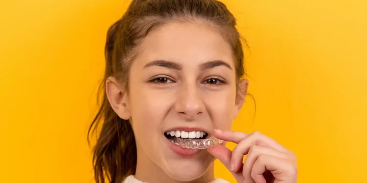 Malocclusioni, un allineatore trasparente per gli adolescenti in fase di crescita